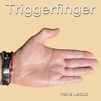 Triggerfinger