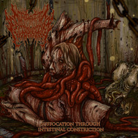 Suffocation Through Intestinal Constriction