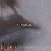 Epistaxis